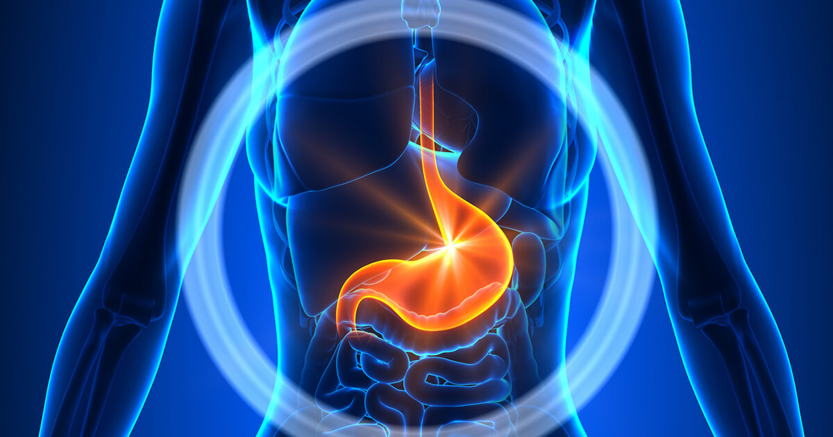 Warum die Türkei das Top-Ziel für eine Magenverkleinerung Türkei ist